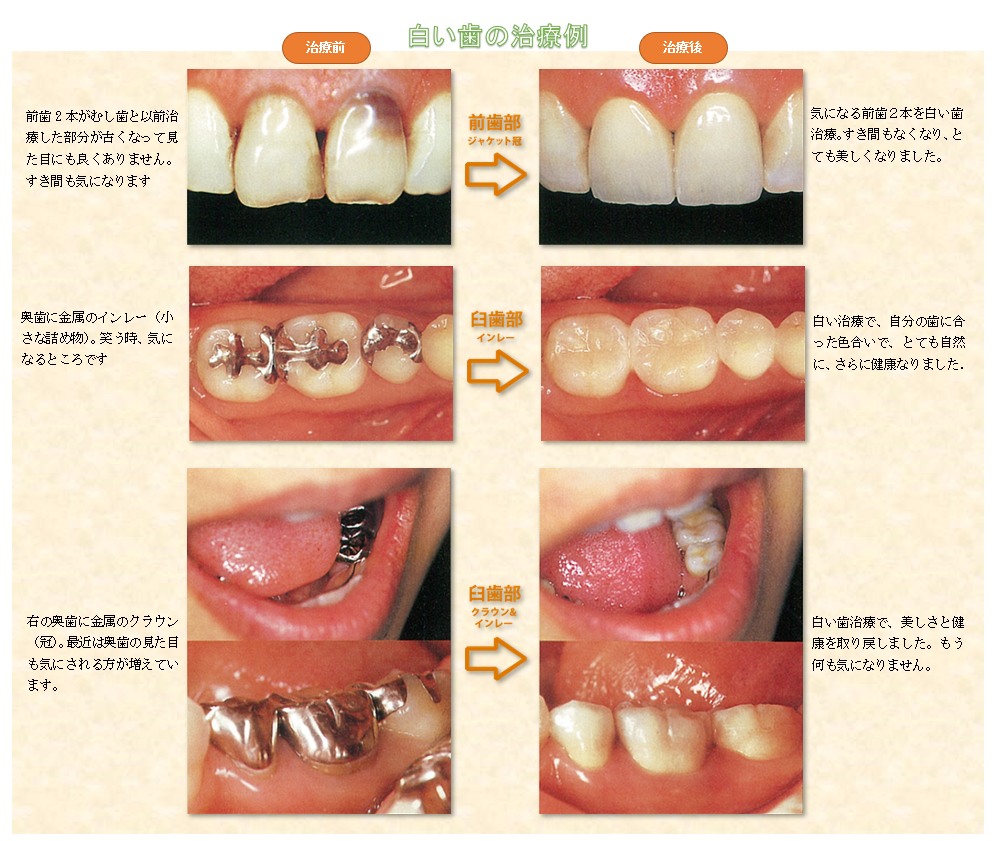 ヒポ通信 江頭歯科医院 Just Another Wordpress Site